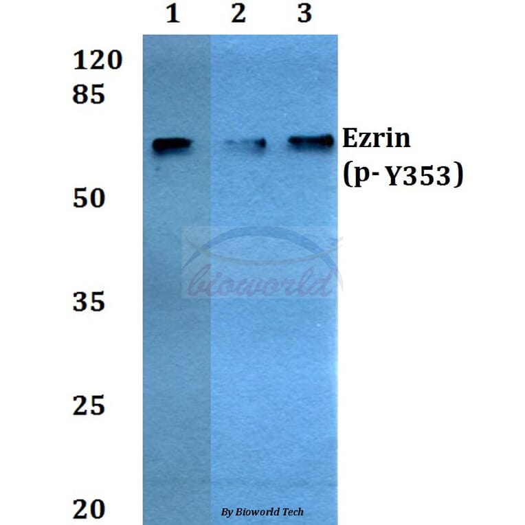 Anti-Ezrin (phospho-Y353) Antibody from Bioworld Technology (BS4073) - Antibodies.com