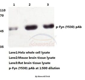Anti-Fyn (phospho-Y530) Antibody from Bioworld Technology (BS4076) - Antibodies.com