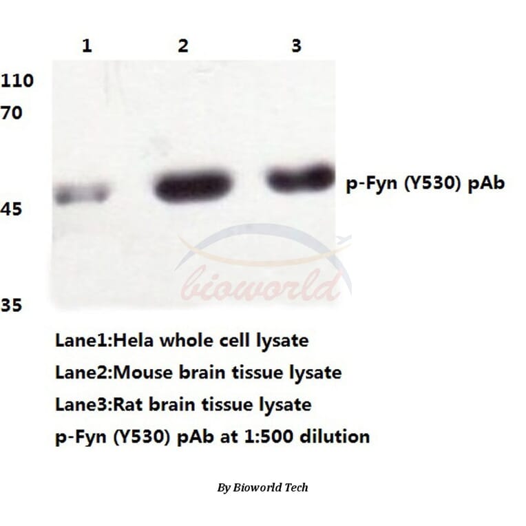 Anti-Fyn (phospho-Y530) Antibody from Bioworld Technology (BS4076) - Antibodies.com