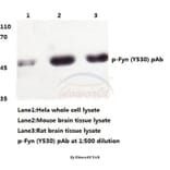 Anti-Fyn (phospho-Y530) Antibody from Bioworld Technology (BS4076) - Antibodies.com