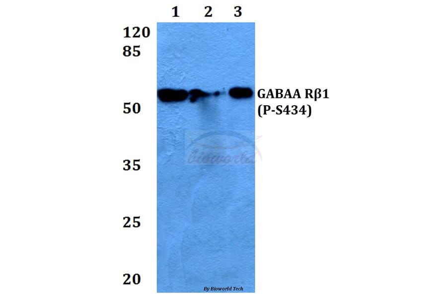 Anti-GABAA Rβ1 (phospho-S434) Antibody from Bioworld Technology (BS4078) - Antibodies.com