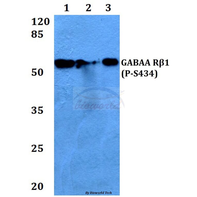 Anti-GABAA Rβ1 (phospho-S434) Antibody from Bioworld Technology (BS4078) - Antibodies.com