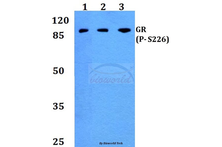 Anti-GR (phospho-S226) Antibody from Bioworld Technology (BS4081) - Antibodies.com