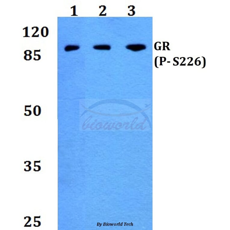 Anti-GR (phospho-S226) Antibody from Bioworld Technology (BS4081) - Antibodies.com