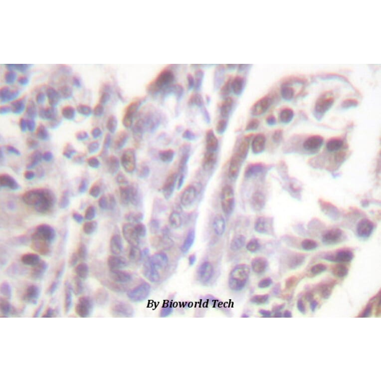 Anti-GR (phospho-S226) Antibody from Bioworld Technology (BS4081) - Antibodies.com