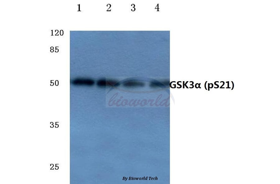 Anti-GSK3α (phospho-S21) Antibody from Bioworld Technology (BS4082) - Antibodies.com