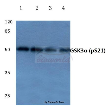 Anti-GSK3α (phospho-S21) Antibody from Bioworld Technology (BS4082) - Antibodies.com