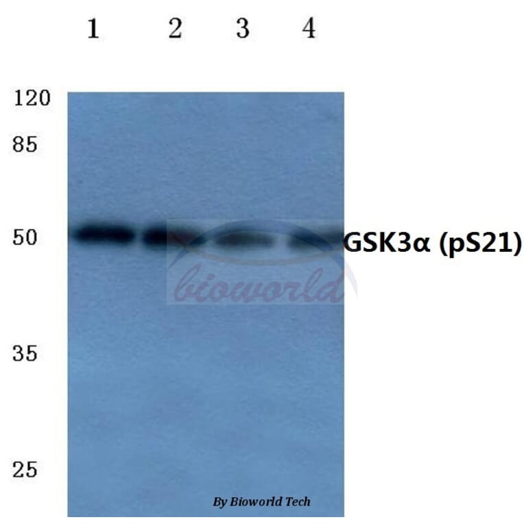 Anti-GSK3α (phospho-S21) Antibody from Bioworld Technology (BS4082) - Antibodies.com