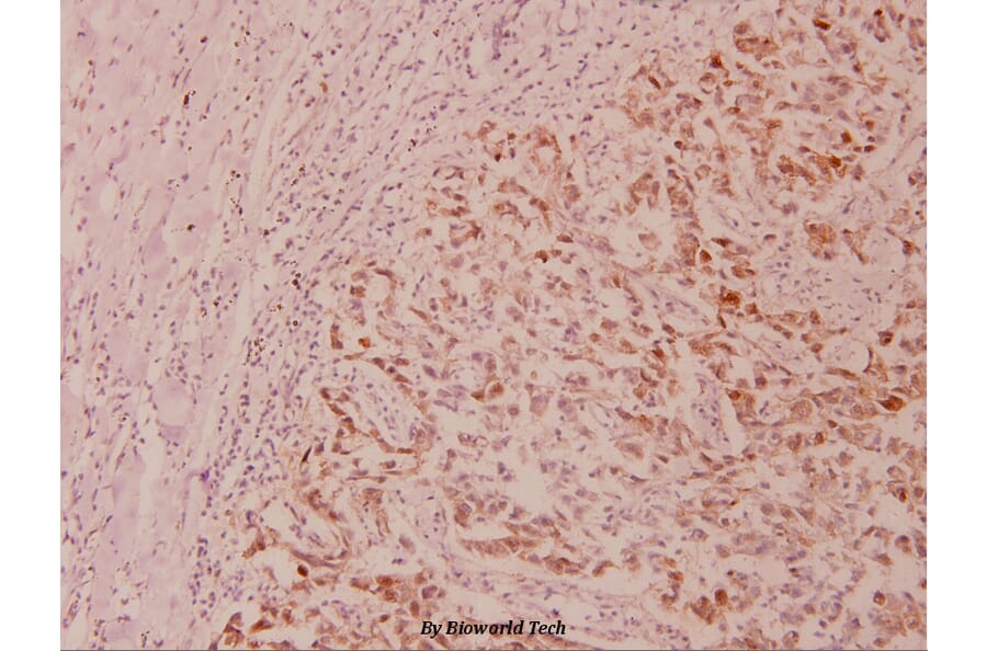 Anti-GSK3α (phospho-S21) Antibody from Bioworld Technology (BS4082) - Antibodies.com