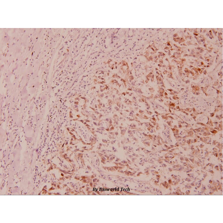 Anti-GSK3α (phospho-S21) Antibody from Bioworld Technology (BS4082) - Antibodies.com