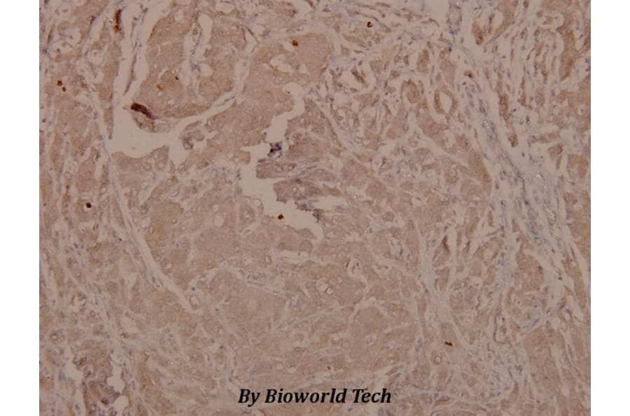 Anti-GSK3α/β (phospho-Y279/216) Antibody from Bioworld Technology (BS4083) - Antibodies.com