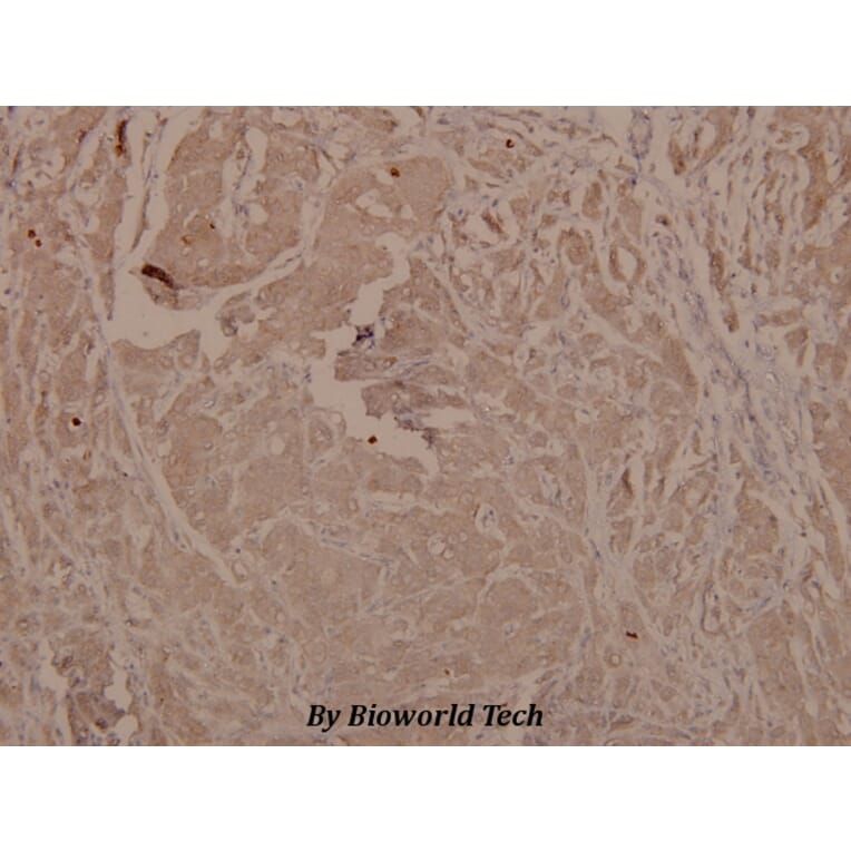Anti-GSK3α/β (phospho-Y279/216) Antibody from Bioworld Technology (BS4083) - Antibodies.com
