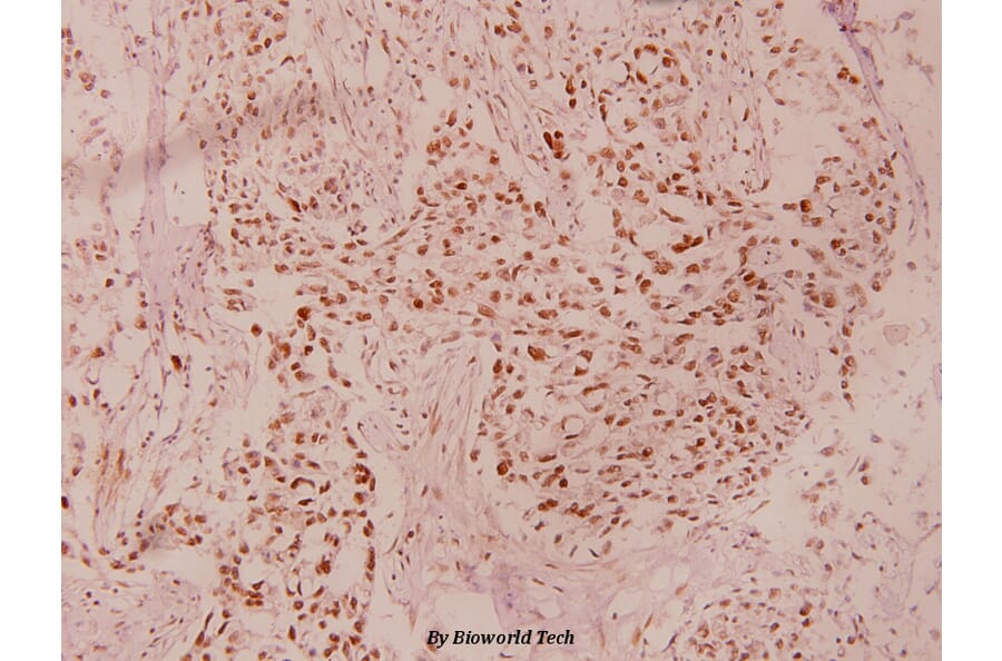 Anti-GSK3β (phospho-S9) Antibody from Bioworld Technology (BS4084) - Antibodies.com