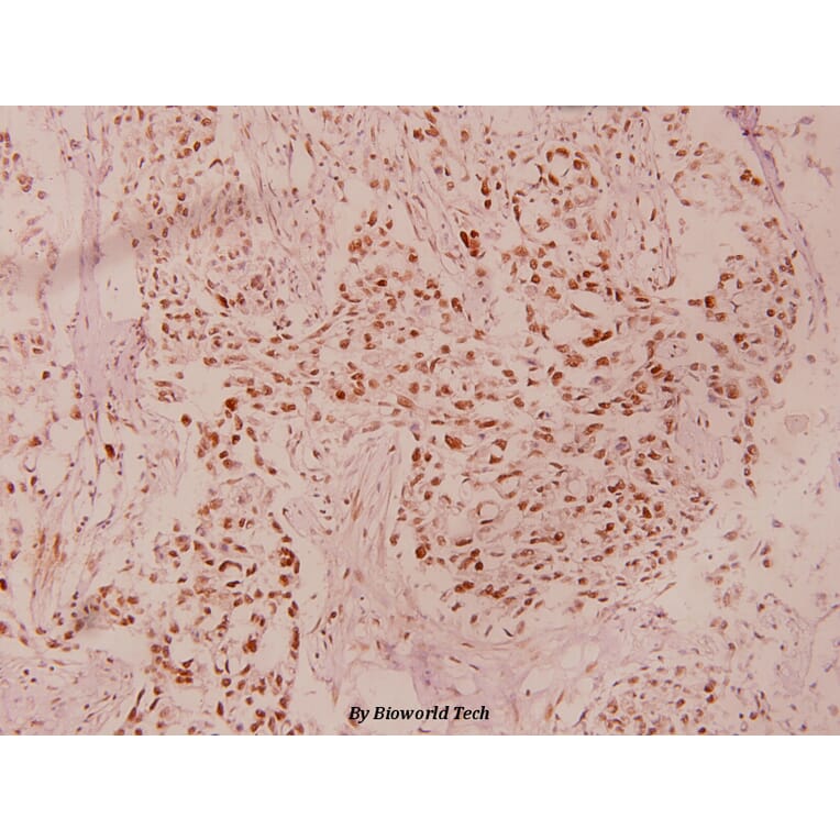 Anti-GSK3β (phospho-S9) Antibody from Bioworld Technology (BS4084) - Antibodies.com