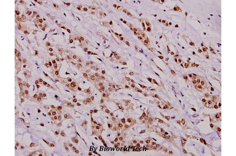 Anti-HDAC8 (phospho-S39) Antibody from Bioworld Technology (BS4087) - Antibodies.com