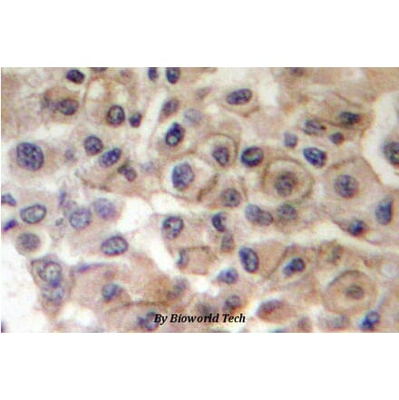 Anti-ErbB2/HER2 Antibody from Bioworld Technology (BS4089) - Antibodies.com