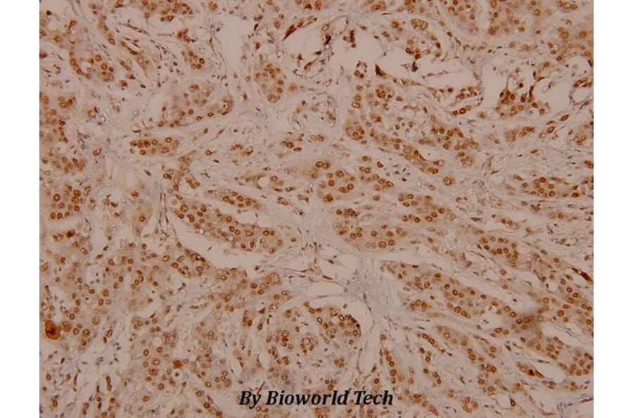Anti-ErbB2/HER2 (phospho-Y1248) Antibody from Bioworld Technology (BS4090) - Antibodies.com