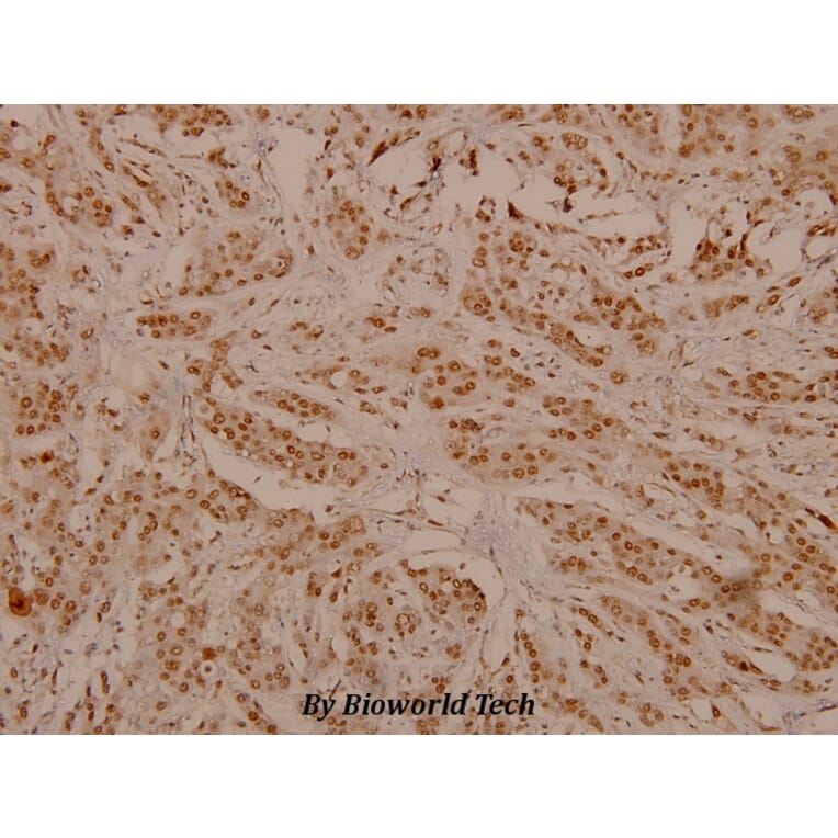 Anti-ErbB2/HER2 (phospho-Y1248) Antibody from Bioworld Technology (BS4090) - Antibodies.com