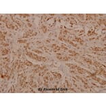 Anti-ErbB2/HER2 (phospho-Y1248) Antibody from Bioworld Technology (BS4090) - Antibodies.com