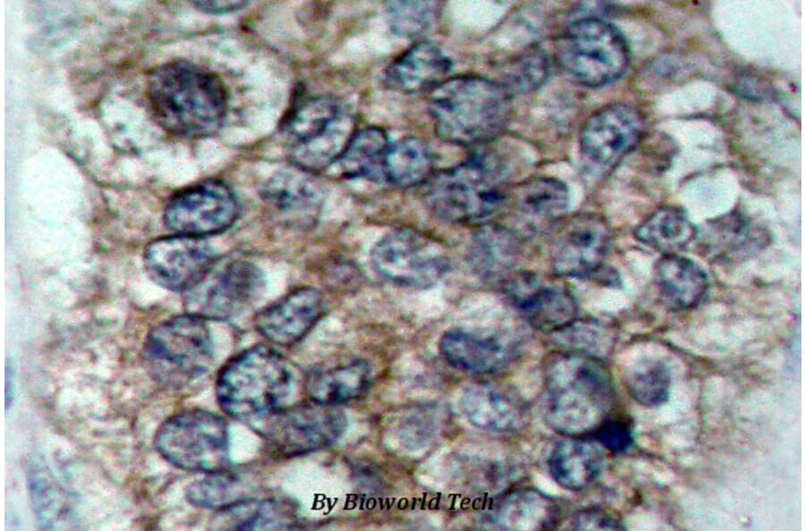 Anti-ErbB2/HER2 (phospho-Y877) Antibody from Bioworld Technology (BS4091) - Antibodies.com