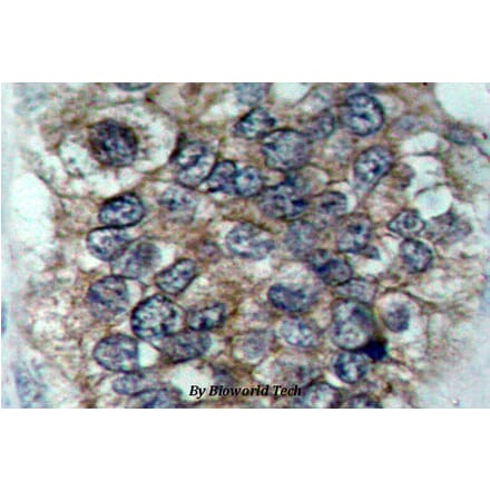 Anti-ErbB2/HER2 (phospho-Y877) Antibody from Bioworld Technology (BS4091) - Antibodies.com
