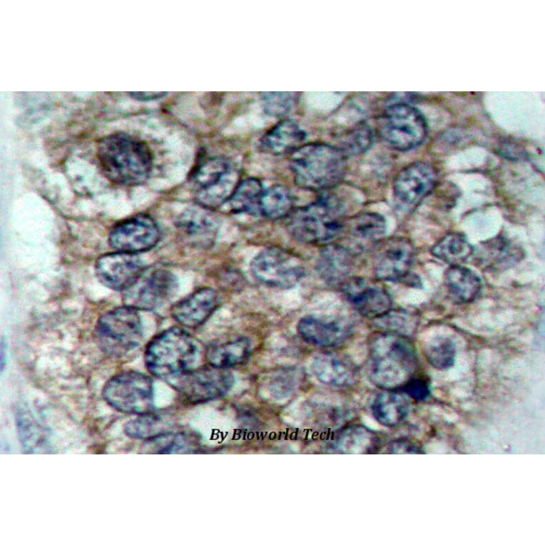 Anti-ErbB2/HER2 (phospho-Y877) Antibody from Bioworld Technology (BS4091) - Antibodies.com
