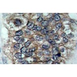 Anti-ErbB2/HER2 (phospho-Y877) Antibody from Bioworld Technology (BS4091) - Antibodies.com