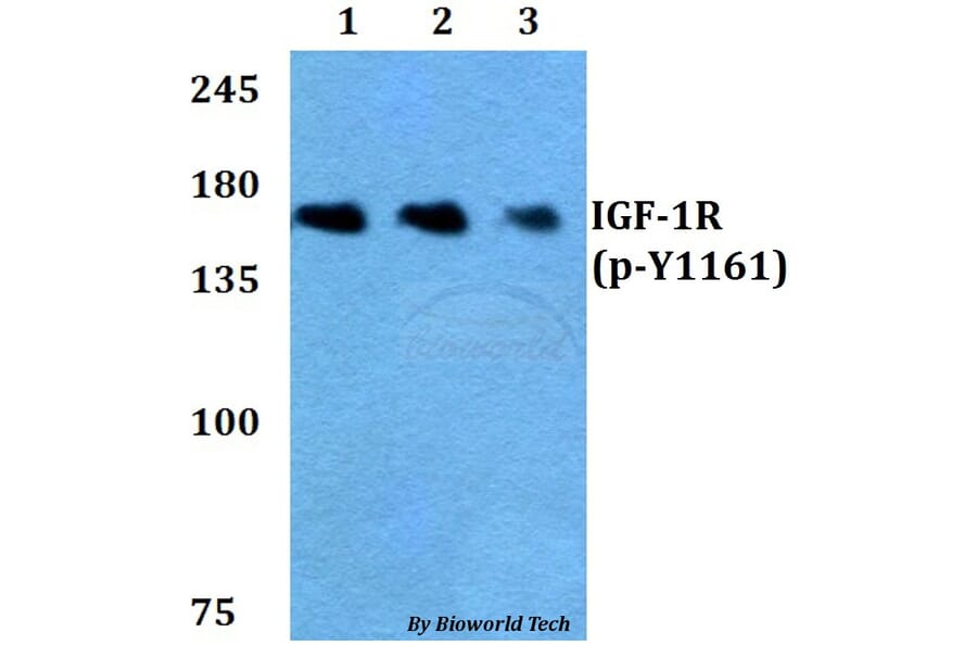 Anti-IGF-1R (phospho-Y1161) Antibody from Bioworld Technology (BS4097) - Antibodies.com