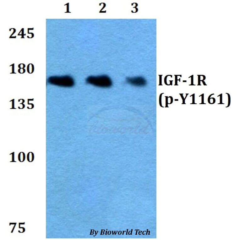 Anti-IGF-1R (phospho-Y1161) Antibody from Bioworld Technology (BS4097) - Antibodies.com