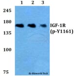 Anti-IGF-1R (phospho-Y1161) Antibody from Bioworld Technology (BS4097) - Antibodies.com
