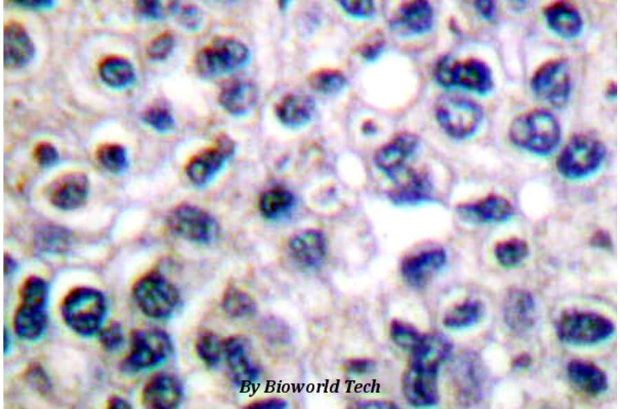 Anti-IGF-1R (phospho-Y1161) Antibody from Bioworld Technology (BS4097) - Antibodies.com