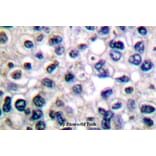Anti-IGF-1R (phospho-Y1161) Antibody from Bioworld Technology (BS4097) - Antibodies.com