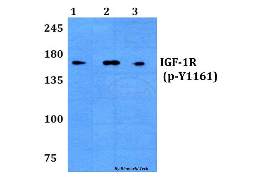 Anti-IGF-1R (phospho-Y1161) Antibody from Bioworld Technology (BS4098) - Antibodies.com