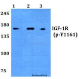 Anti-IGF-1R (phospho-Y1161) Antibody from Bioworld Technology (BS4098) - Antibodies.com