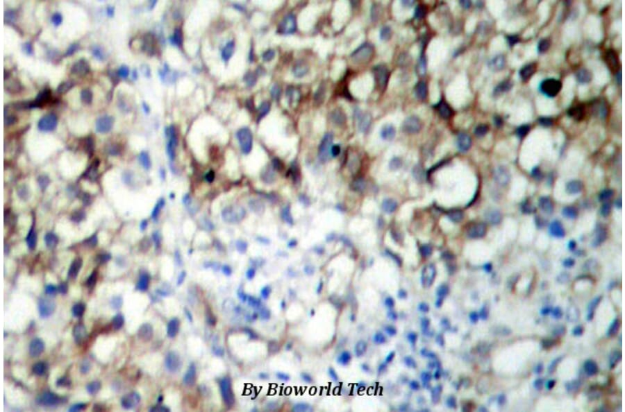 Anti-IGF-1R (phospho-Y1161) Antibody from Bioworld Technology (BS4098) - Antibodies.com