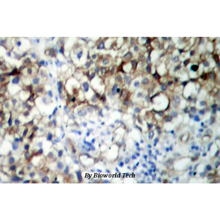 Anti-IGF-1R (phospho-Y1161) Antibody from Bioworld Technology (BS4098) - Antibodies.com