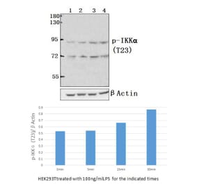 Anti-IKKα (phospho-T23) Antibody from Bioworld Technology (BS4100) - Antibodies.com