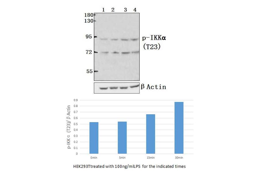 Anti-IKKα (phospho-T23) Antibody from Bioworld Technology (BS4100) - Antibodies.com