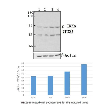 Anti-IKKα (phospho-T23) Antibody from Bioworld Technology (BS4100) - Antibodies.com