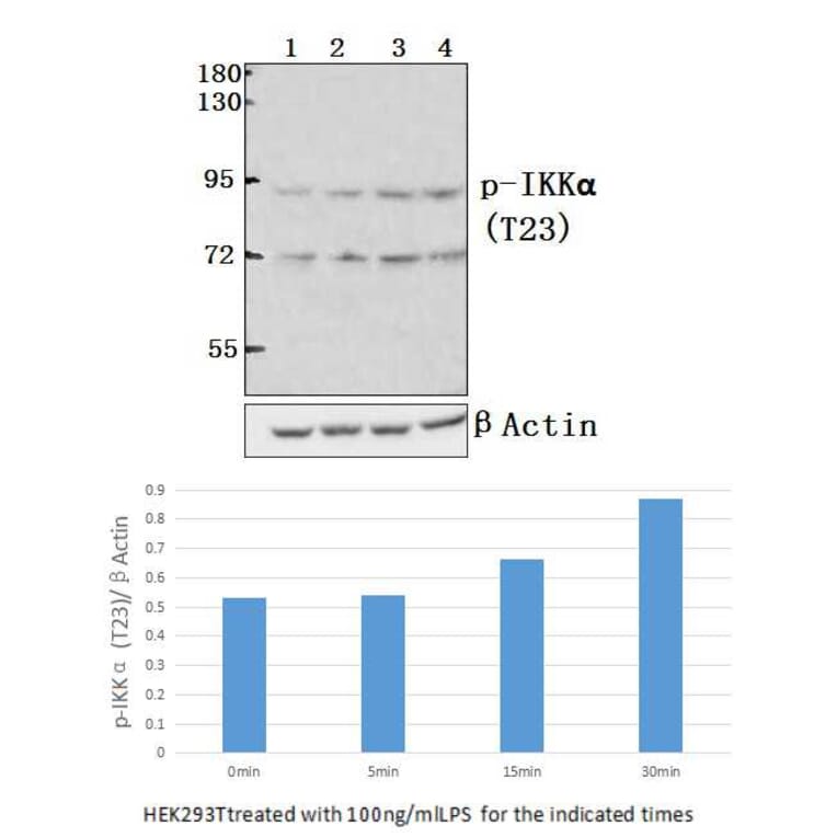 Anti-IKKα (phospho-T23) Antibody from Bioworld Technology (BS4100) - Antibodies.com