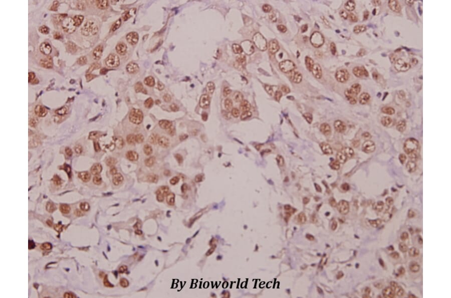 Anti-IKKα (phospho-T23) Antibody from Bioworld Technology (BS4100) - Antibodies.com