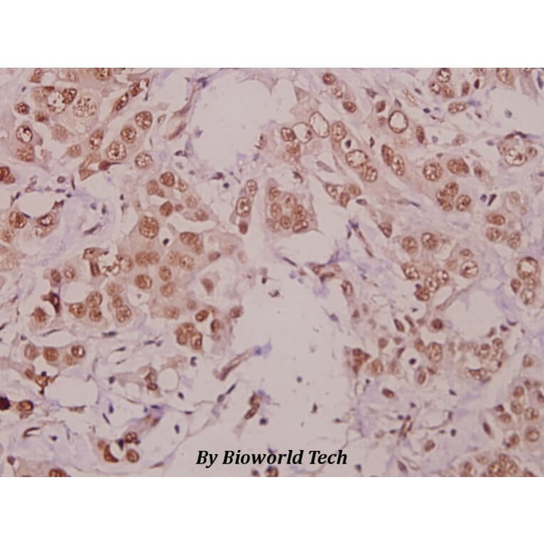 Anti-IKKα (phospho-T23) Antibody from Bioworld Technology (BS4100) - Antibodies.com