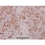 Anti-IKKα (phospho-T23) Antibody from Bioworld Technology (BS4100) - Antibodies.com