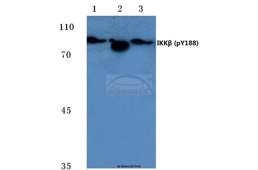 Anti-IKKβ (phospho-Y188) Antibody from Bioworld Technology (BS4101) - Antibodies.com