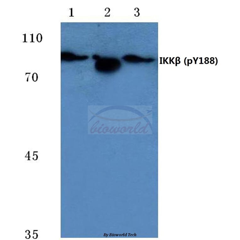 Anti-IKKβ (phospho-Y188) Antibody from Bioworld Technology (BS4101) - Antibodies.com