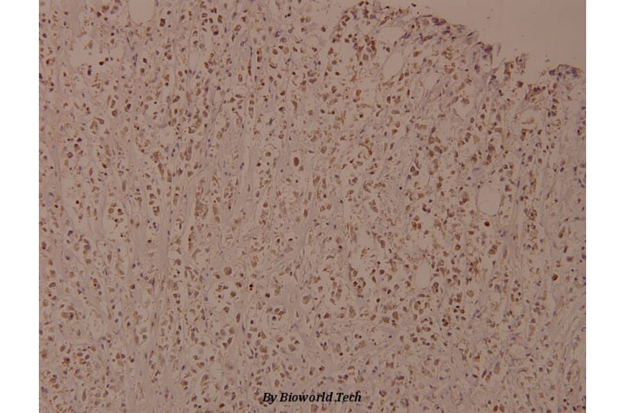 Anti-IKKβ (phospho-Y188) Antibody from Bioworld Technology (BS4101) - Antibodies.com