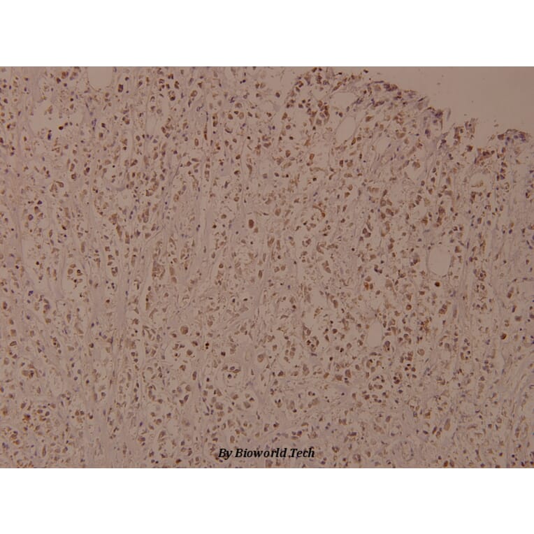 Anti-IKKβ (phospho-Y188) Antibody from Bioworld Technology (BS4101) - Antibodies.com