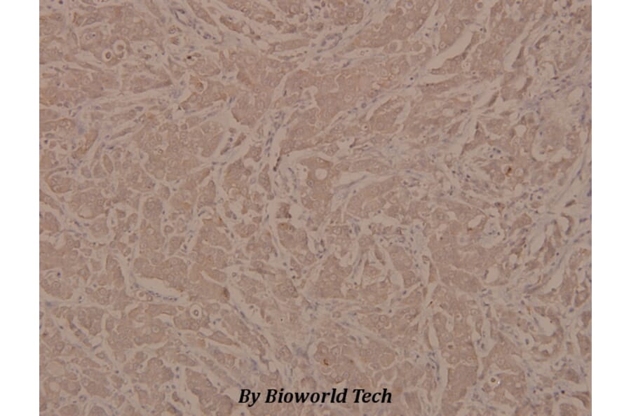 Anti-Integrin β3 (phospho-Y773) Antibody from Bioworld Technology (BS4103) - Antibodies.com