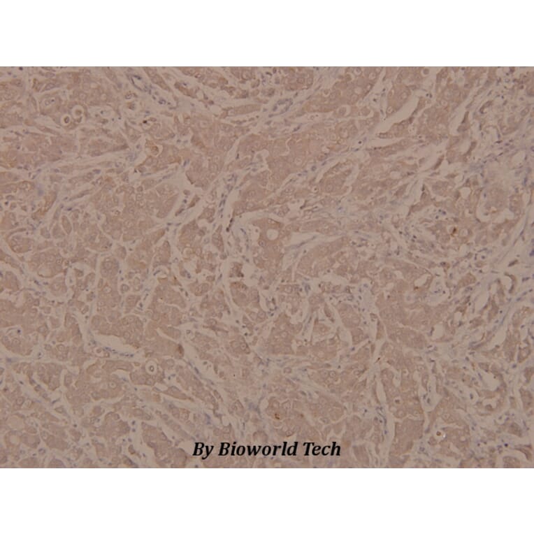 Anti-Integrin β3 (phospho-Y773) Antibody from Bioworld Technology (BS4103) - Antibodies.com