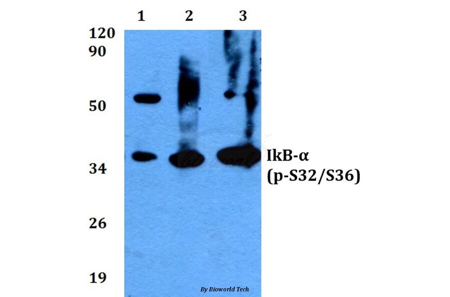 Anti-IkB-α (phospho-S32/S36) Antibody from Bioworld Technology (BS4105) - Antibodies.com